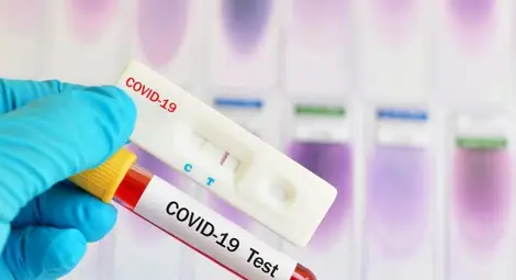 Всеки пети в областта се е срещнал с Ковид-19 от началото на пандемията