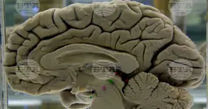 Упражненията за мозъка могат да намалят риска от деменция, показва проучване