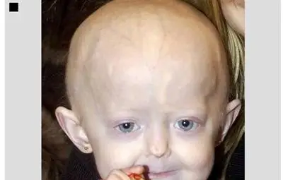 17-годишно момиче почина в тялото на 100-годишна старица