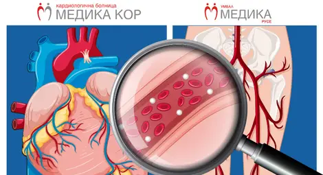 Кампанията на "МЕДИКА&rdquo; за профилактика на исхемичната болест на сърцето и периферната съдова болест продължава и през месец юли