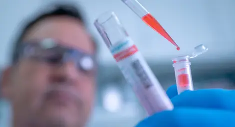 ЕМА започна цялостна оценка на Sotrovimab за лечение на COVID-19