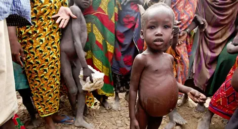 УНИЦЕФ: Близо 90 000 нигерийски деца се очаква да починат от глад до края на годината