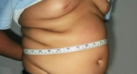 България шеста в ЕС по затлъстели деца