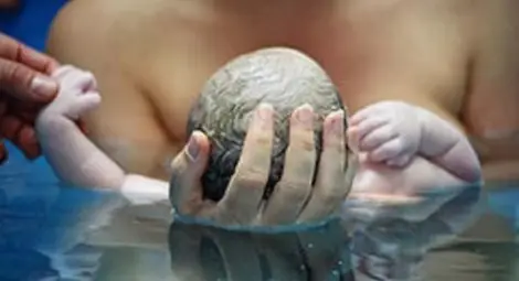 Раждането във вода е опасно за здравето Раждането във вода е опасно за здравето