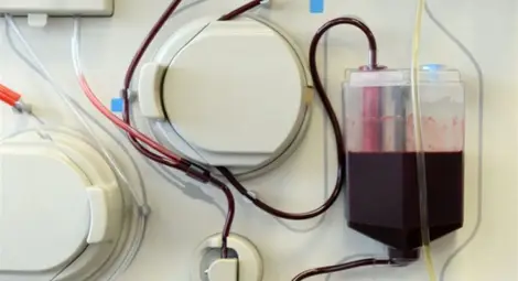 Д-р Чавдар Ботев: Плазмаферезата стана първа линия на терапия от коронавирус