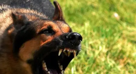 Кучета разкъсаха лицето на жена