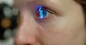 Преглеждат безплатно за глаукома в болница „Медика“