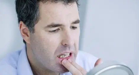 5 причини да се тревожите заради кръв от венците 5 причини да се тревожите заради кръв от венците