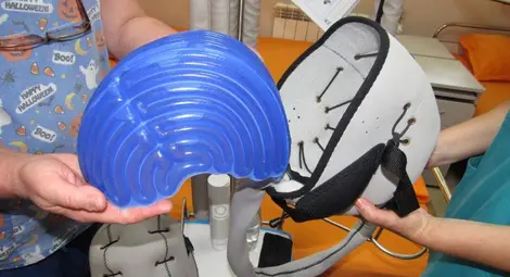 Създаден за болна съпруга апарат спасява косата при химиотерапия в Онкоцентъра