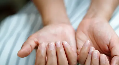 Скрити здравословни проблеми, които предизвикват промени в ноктите