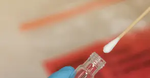 Лабораторията за изследване на Ковид в болница „Канев“ прави 4 вида тестов