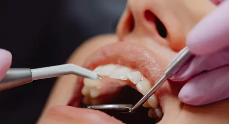 Зъболекарка плаща 9500 лева на пациентка заради некачествено лечение