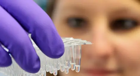 Учени от 30 страни разкриха причините за почти всички видове рак