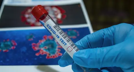 3938 са новозаразените с коронавирус - 39,6% от тестваните, починали са 117