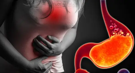 Киселини в стомаха? Не ги пренебрегвайте