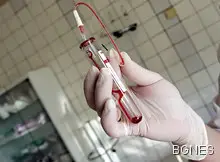 Кръвта на тъмнокожите се съсирва по-лесно