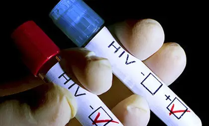 Краят на СПИН до 2030 г. е възможен