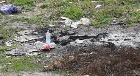 Клошар обгоря жестоко в запален за сгряване огън