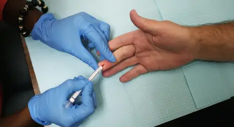 НЗОК ще заплаща най-съвременното лечение на пациенти с хепатит С