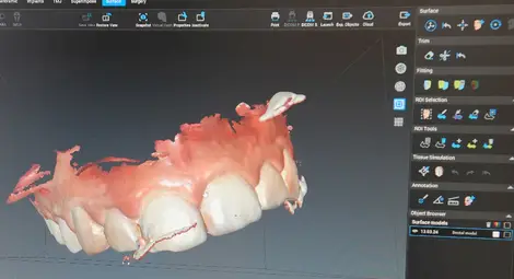 Уникален 3D дентален скенер от последно поколение работи в "Медика"