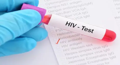 Шест нови случая наредиха Русе на пето място по ХИВ позитивни