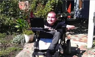 Присаждат главата на болен руснак върху здраво тяло