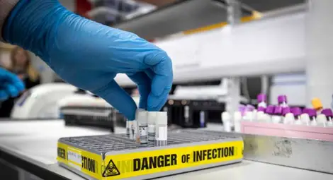 Мерките, които предприеха държавите в борбата срещу COVID-19