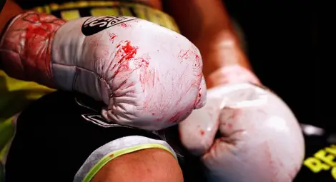 Австралийски боксьор почина от раните си след нокаут