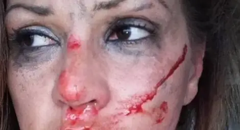 Битата Сани Алекса с нови разкрития за насилника си и преживения ужас (Видео) Битата Сани Алекса с нови разкрития за насилника си и преживения ужас (Видео)