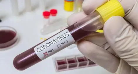 Болните от коронавирус в Русе надхвърлиха 100