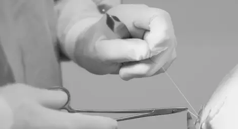 Учени пращат хирургическата игла и конеца в историята