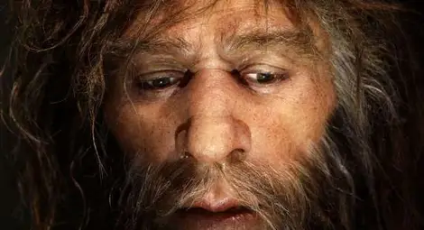 И неандерталецът е страдал от рак