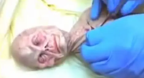 Сами ли сме във Вселената? Разкриха секретна аутопсия на извънземно /видео 18+/