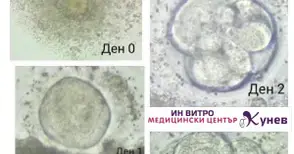 Д-р Александър Кунев: Помогнал съм за всички над 50 ин витро бебета в Русе