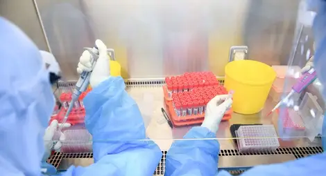 84% от заразените са от община Русе, следват Сливо поле и Иваново