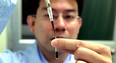 Болестта на Алцхаймер е заразна и се предава по кръвен път