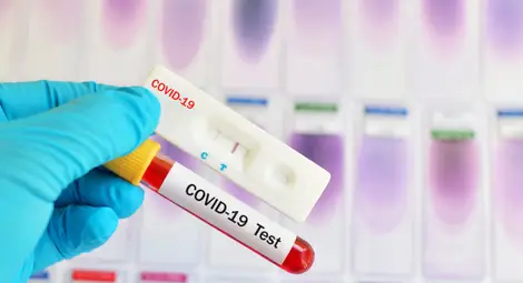 232 са новите случаи на COVID-19 у нас, 6-има починаха за ден 232 са новите случаи на COVID-19 у нас, 6-има починаха за ден