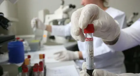 Вируси през март: Бум на варицела и скарлатина