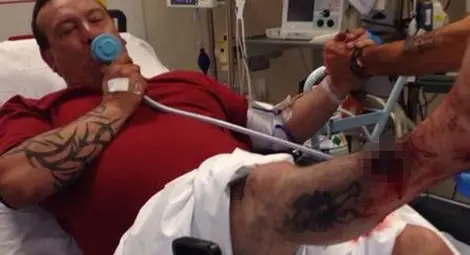 Електронна цигара се взриви в ръцете на мъж