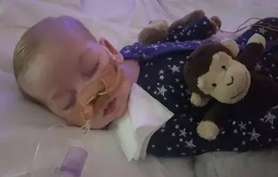 Страдащото от рядка болест британско бебе Чарли Гард почина