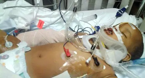 Бебе в Минесота падна от 11-я етаж и оцеля