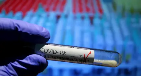 Германия преживява тревожен скок в случаите на коронавирус