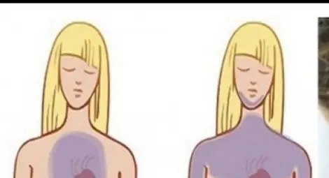 Косата ви алармира месеци по-рано, че ще получите инфаркт!