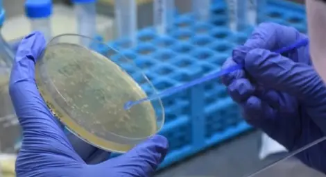 11 нови случая, 4 оздравели и един починал от коронавирус през последното денонощие в Русенска област