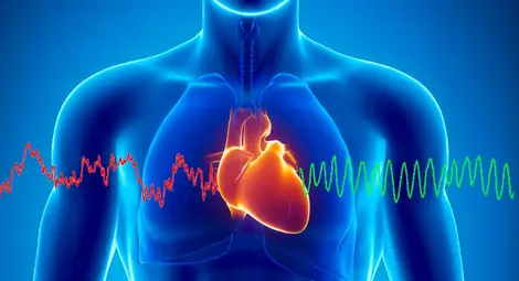 Изкуствен интелект предсказва инфаркт по-точно от лекар