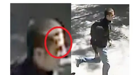 Кръв по главата на заснетия след убийството Георги Игнатов в Борисовата градина