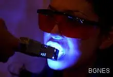 Водата за уста повишава риска от инфаркт и инсулт Водата за уста повишава риска от инфаркт и инсулт