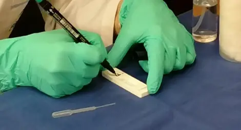 2181 са новозаразените у нас 2181 са новозаразените у нас