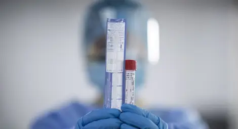 Откриха &bdquo;слабото място&rdquo; на коронавируса