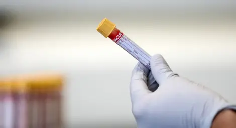 Двама от заместник-кметовете в Община Русе са с COVID-19 Двама от заместник-кметовете в Община Русе са с COVID-19